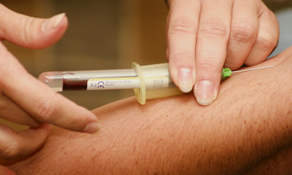 Testosteroncypionaat en de eigen hormoonproductie